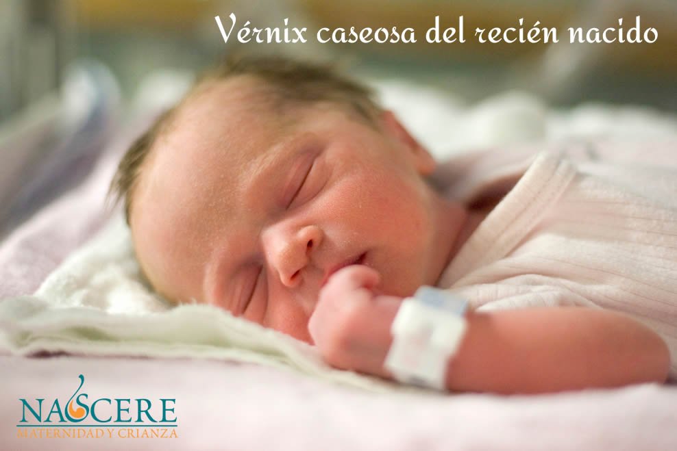 Vernix caseosa del recien nacido